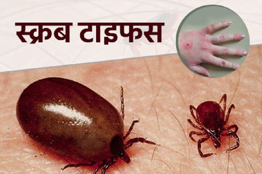 बर्दगोरियामा स्क्रब टाइफसका बिरामी बढ्दै